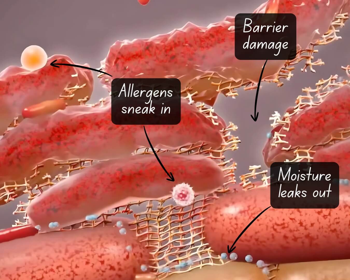 Illustration of a damaged skin barrier: allergens getting in and moisture leaking out